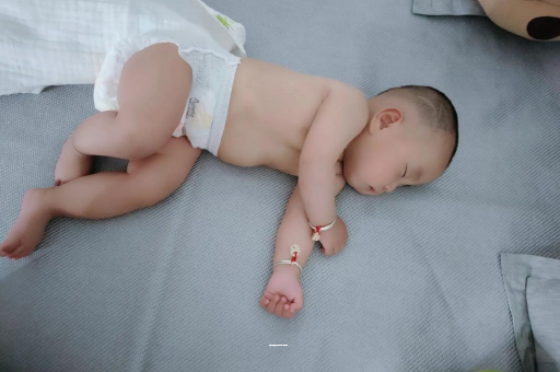 兰考宝宝上火有眼屎